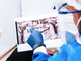 medicos cirugia oral maxilofacial arequipa Dr. Christian Farfán- Cirugía Maxilofacial
