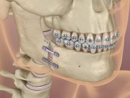 medicos cirugia oral maxilofacial arequipa Dr. Christian Farfán- Cirugía Maxilofacial